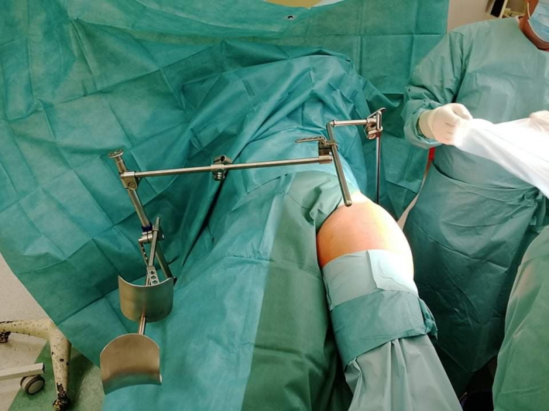 Rozvěrač u operace nahradí jednoho asistenta