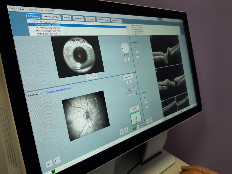 Optický koherentní tomograf si nově posvítí do očí pacientů očního oddělení